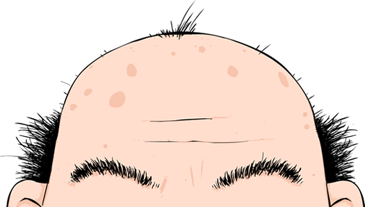 Name: SCALP.png Views: 842 Size: 44.6 KB